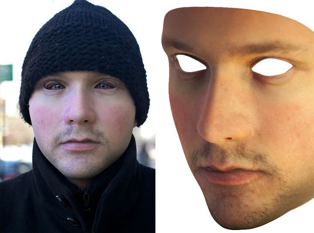 URME Surveillance